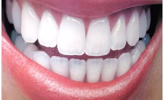 Yanlış diş macunu seçimi ve fırçalama diş kaybına neden oluyor